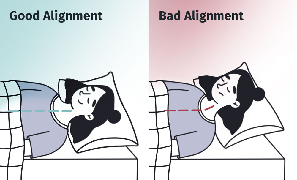 A graphic depicting the correct and incorrect alignment for back sleeping.