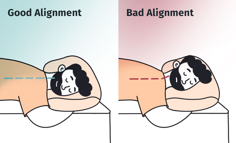 A graphic depicting the correct and incorrect alignment for stomach sleeping.