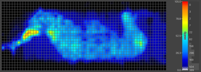 Pressure map of a heavier side-sleeper on the Saatva Rx mattress