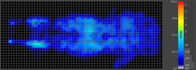 Pressure map of an average-weight back-sleeper on the Saatva Rx mattress